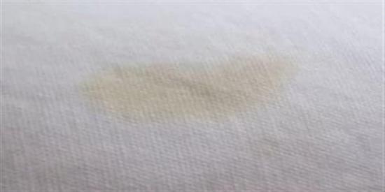Pas lekesi kumaştan nasıl çıkar ham kumaş yağ çözücü Asit bazlı ürün ile